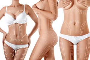 Moeller Medical liposuction blog 2 banner 1600x1067px