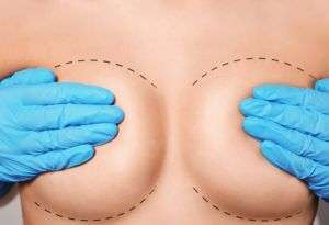 What Is Breast Augmentation & What Are The Different Types? Luxor Hospital